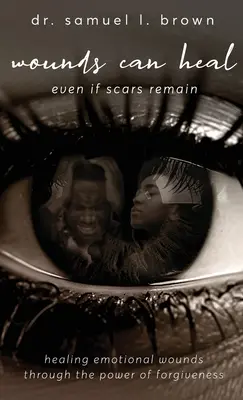 Las heridas pueden cicatrizar, Curar las heridas emocionales mediante el poder del perdón - Wounds Can Heal, Healing Emotional Wounds Through the Power of Forgiveness