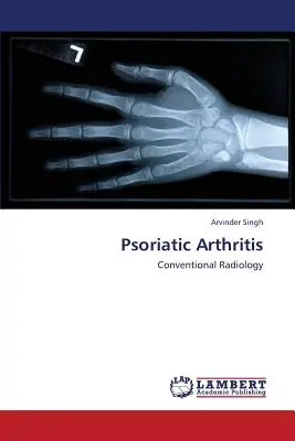 Artritis psoriásica - Psoriatic Arthritis