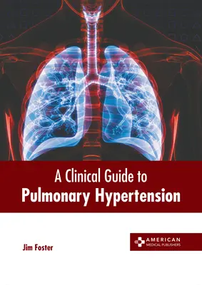 Guía clínica de la hipertensión pulmonar - A Clinical Guide to Pulmonary Hypertension