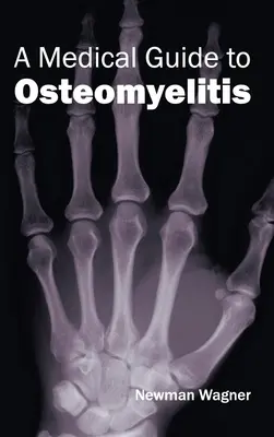 Guía médica de la osteomielitis - Medical Guide to Osteomyelitis