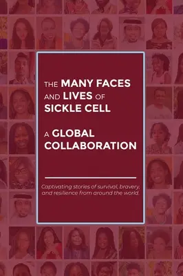 Las muchas caras y vidas de la anemia falciforme: una colaboración mundial - The Many Faces and Lives of Sickle Cell - A Global Collaboration