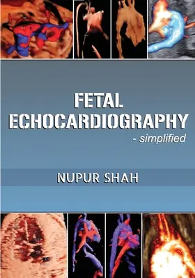 Ecocardiografía Fetal - Simplificada - Fetal Echocardiography - Simplified