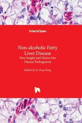 La enfermedad del hígado graso no alcohólico: nueva visión y mirada a la patogénesis de la enfermedad - Non-alcoholic Fatty Liver Disease - New Insight and Glance Into Disease Pathogenesis