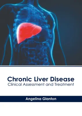 Chronic Liver Disease: Evaluación clínica y tratamiento - Chronic Liver Disease: Clinical Assessment and Treatment