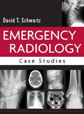 Radiología de urgencias: Casos prácticos - Emergency Radiology: Case Studies