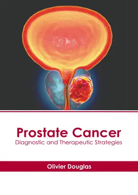 Cáncer de Próstata: Estrategias diagnósticas y terapéuticas - Prostate Cancer: Diagnostic and Therapeutic Strategies