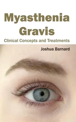 Miastenia Gravis: Conceptos clínicos y tratamientos - Myasthenia Gravis: Clinical Concepts and Treatments