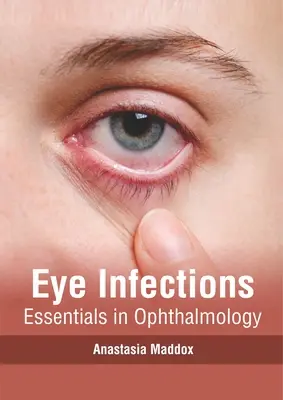 Infecciones Oculares: Essentials in Ophthalmology - Eye Infections: Essentials in Ophthalmology