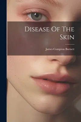 Enfermedades de la piel - Disease Of The Skin