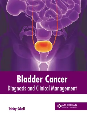 Cáncer de vejiga: Diagnóstico y manejo clínico - Bladder Cancer: Diagnosis and Clinical Management