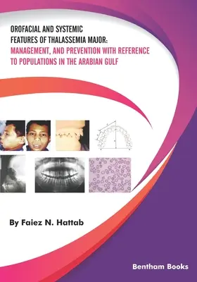 Características orofaciales y sistémicas de la talasemia mayor: Gestión y Prevención con Referencia a las Poblaciones del Golfo Arábigo - Orofacial and Systemic Features of Thalassemia Major: Management, and Prevention with Reference to Populations in the Arabian Gulf