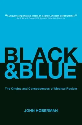 Negro y azul: Orígenes y consecuencias del racismo médico - Black and Blue: The Origins and Consequences of Medical Racism