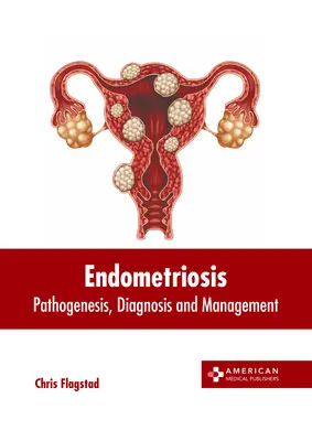 Endometriosis: Patogénesis, diagnóstico y tratamiento - Endometriosis: Pathogenesis, Diagnosis and Management