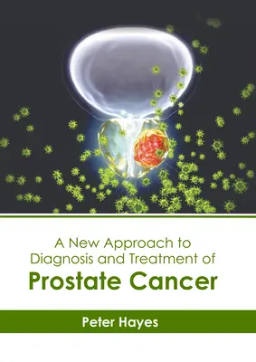 Un nuevo enfoque para el diagnóstico y tratamiento del cáncer de próstata - A New Approach to Diagnosis and Treatment of Prostate Cancer