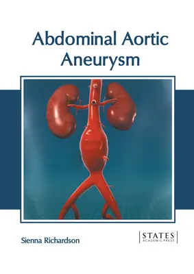 Aneurisma aórtico abdominal - Abdominal Aortic Aneurysm