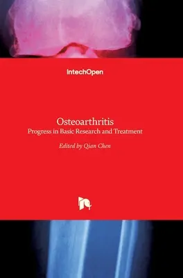 Osteoartritis: Avances en investigación básica y tratamiento - Osteoarthritis: Progress in Basic Research and Treatment