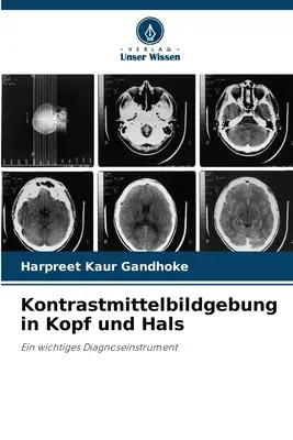 Kontrastmittelbildgebung in Kopf und Hals