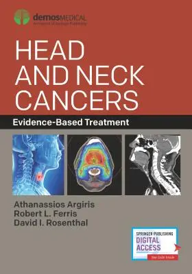 Cánceres de cabeza y cuello: Tratamiento basado en la evidencia - Head and Neck Cancers: Evidence-Based Treatment