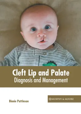 Labio leporino y paladar hendido: Diagnóstico y tratamiento - Cleft Lip and Palate: Diagnosis and Management