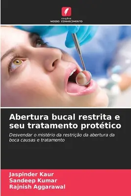 Abertura bucal restrita e seu tratamento protético - Abertura bucal restrita e seu tratamento prottico