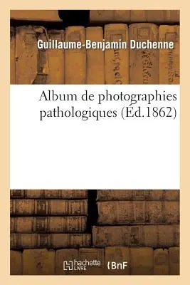 Álbum De Fotografías Patológicas, Complemento Del Libro Intitulado De La Lectura Localizada - Album de Photographies Pathologiques, Complmentaire Du Livre Intitul de l'lectrisation Localise