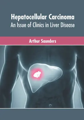 Carcinoma hepatocelular: Un número de Clinics in Liver Disease - Hepatocellular Carcinoma: An Issue of Clinics in Liver Disease