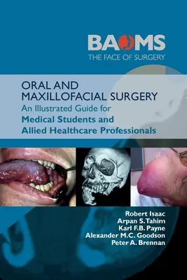 Cirugía Oral y Maxilofacial: Una guía ilustrada para estudiantes de medicina y profesionales sanitarios:: Una guía ilustrada para estudiantes de medicina - Oral and Maxillofacial Surgery: An Illustrated Guide for Medical Students and Allied Healthcare Professionals:: An Illustrated Guide for Medical Stude