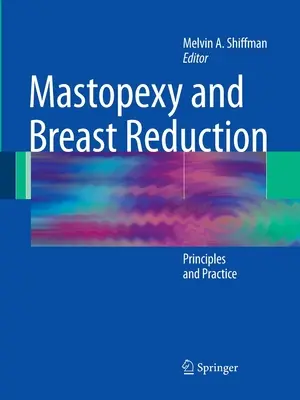 Mastopexia y Reducción Mamaria: Principios y práctica - Mastopexy and Breast Reduction: Principles and Practice