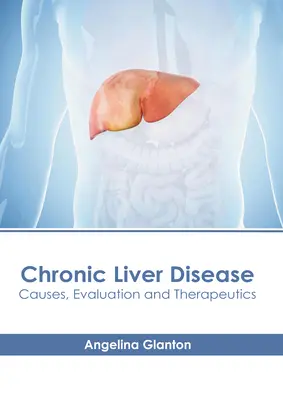 Enfermedad Hepática Crónica: Causas, Evaluación y Terapéutica - Chronic Liver Disease: Causes, Evaluation and Therapeutics