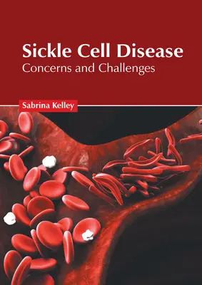 La anemia falciforme: Preocupaciones y desafíos - Sickle Cell Disease: Concerns and Challenges