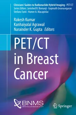 Pet/TC en el cáncer de mama - Pet/CT in Breast Cancer