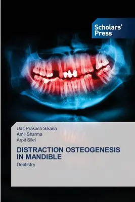 Osteogénesis por distracción en la mandíbula - Distraction Osteogenesis in Mandible