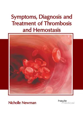 Síntomas, diagnóstico y tratamiento de la trombosis y la hemostasia - Symptoms, Diagnosis and Treatment of Thrombosis and Hemostasis