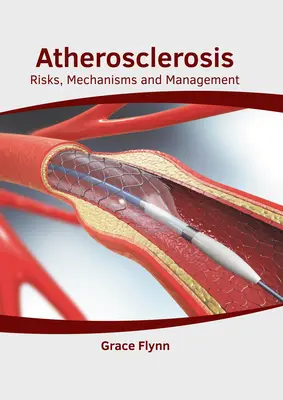 Aterosclerosis: Riesgos, mecanismos y tratamiento - Atherosclerosis: Risks, Mechanisms and Management