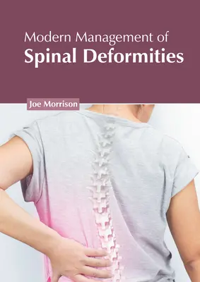 Tratamiento moderno de las deformidades de la columna vertebral - Modern Management of Spinal Deformities