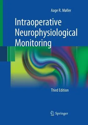 Monitorización Neurofisiológica Intraoperatoria - Intraoperative Neurophysiological Monitoring