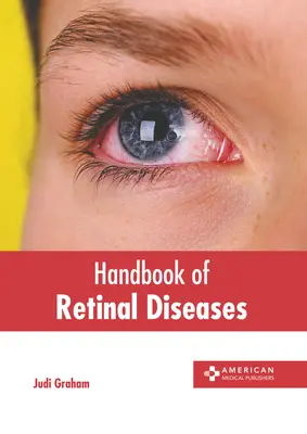 Manual de enfermedades de la retina - Handbook of Retinal Diseases