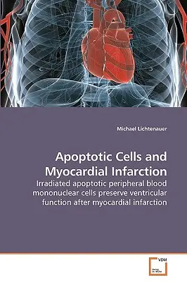 Células apoptóticas e infarto de miocardio - Apoptotic Cells and Myocardial Infarction