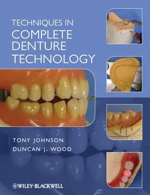 Técnicas de prótesis completa - Techniques in Complete Denture