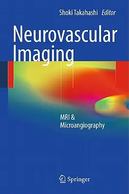 Neurovascular Imaging: Resonancia magnética y microangiografía - Neurovascular Imaging: MRI & Microangiography