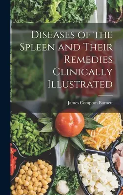 Enfermedades del Bazo y sus Remedios Clínicamente Ilustrados - Diseases of the Spleen and Their Remedies Clinically Illustrated