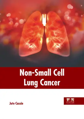 Cáncer de pulmón de células no pequeñas - Non-Small Cell Lung Cancer