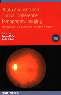 Tomografía de coherencia óptica y fotoacústica: Angiografía: - Una aplicación en la obtención de imágenes de vasos sanguíneos - Photo Acoustic and Optical Coherence Tomography Imaging: Angiography: - An Application in Vessel Imaging