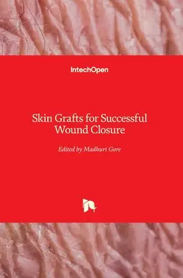 Injertos de piel para cerrar heridas con éxito - Skin Grafts for Successful Wound Closure