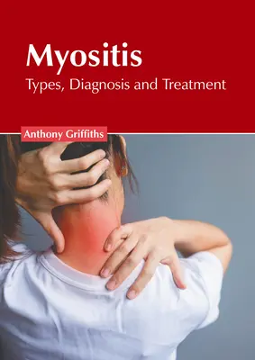 Miositis: Tipos, diagnóstico y tratamiento - Myositis: Types, Diagnosis and Treatment