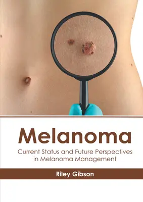 Melanoma: Situación actual y perspectivas de futuro en el tratamiento del melanoma - Melanoma: Current Status and Future Perspectives in Melanoma Management