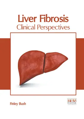 Fibrosis Hepática: Perspectivas Clínicas - Liver Fibrosis: Clinical Perspectives