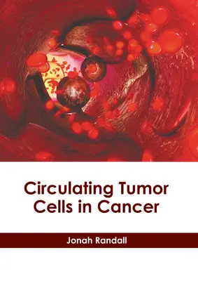 Células tumorales circulantes en el cáncer - Circulating Tumor Cells in Cancer