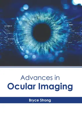 Avances en imagen ocular - Advances in Ocular Imaging