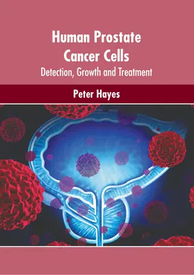 Células de cáncer de próstata humano: Detección, crecimiento y tratamiento - Human Prostate Cancer Cells: Detection, Growth and Treatment